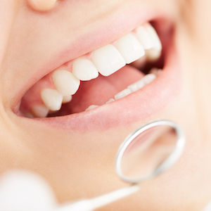 Patient Smiling at Dentist Patient Smiling at Dentist